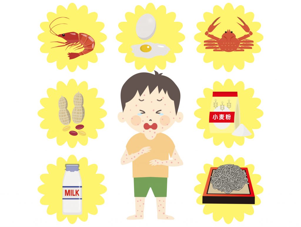 食物アレルギーを知ろう！！ | kids-consult-clinic